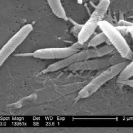 Что нужно знать о Helicobacter pylori (Хеликобактер пилори)?