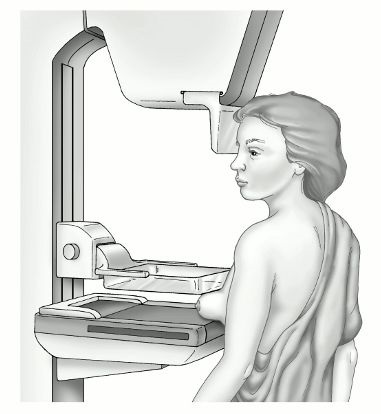 Mammography